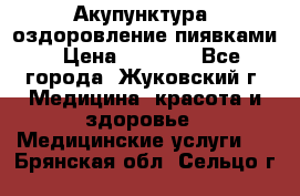 Акупунктура, оздоровление пиявками › Цена ­ 3 000 - Все города, Жуковский г. Медицина, красота и здоровье » Медицинские услуги   . Брянская обл.,Сельцо г.